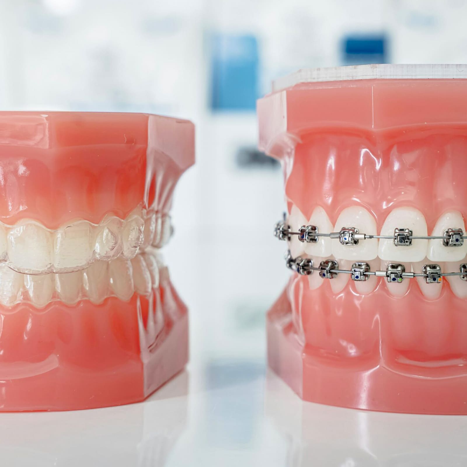 Neviditeľné zubné strojčeky Invisalign - výhody