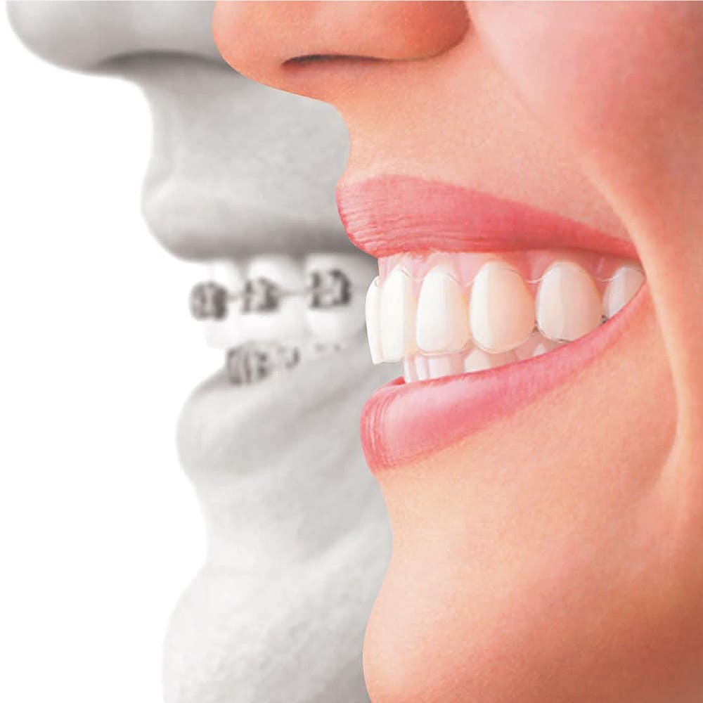 Stomatologická klinika DENTAKRA Poprad - Váš špecialista na zubné strojčeky